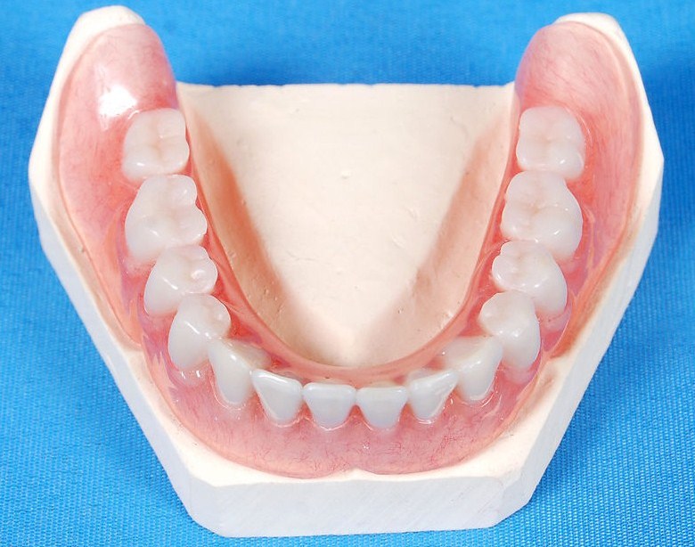 Acrylic Partial Global Dental Lab
