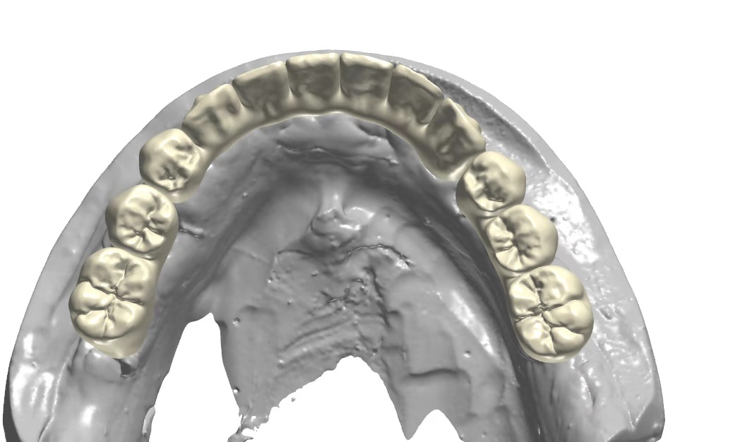 Global Dental Lab Data Design