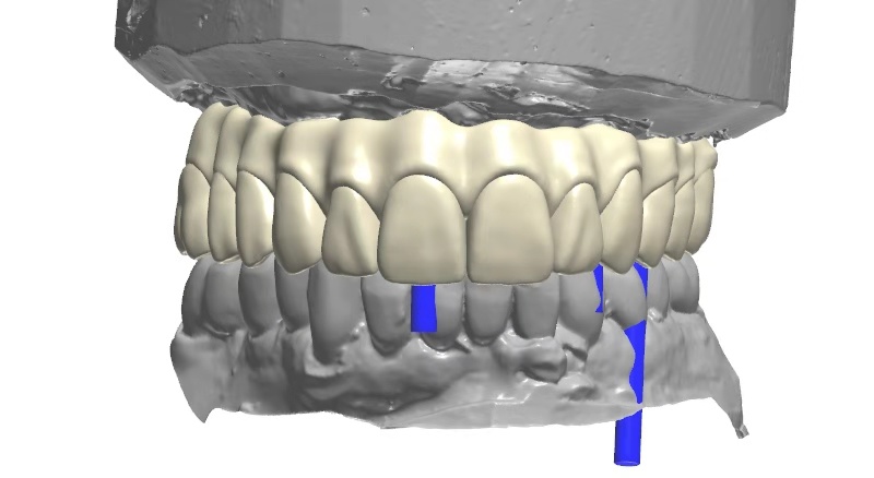 Global Dental Lab Data Design