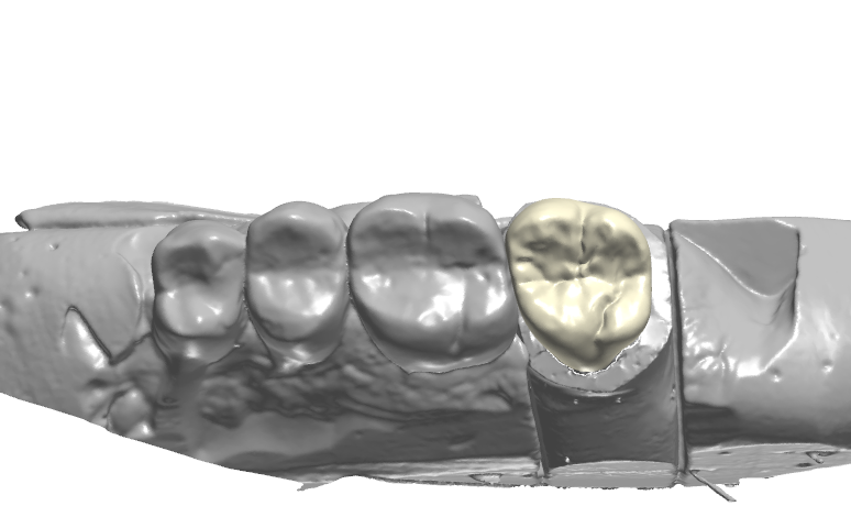 Global Dental Lab Data Design