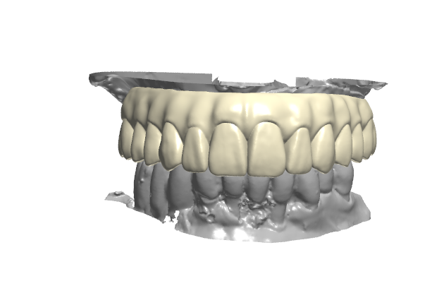 Global Dental Lab Data Design