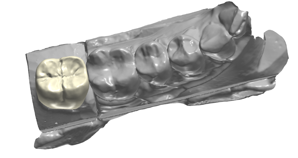 Global Dental Lab Data Design