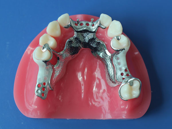 Global Dental Lab: CCP Framework 2