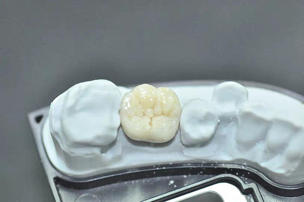 Global Dental  Lab: Ceramic Zirconia 3
