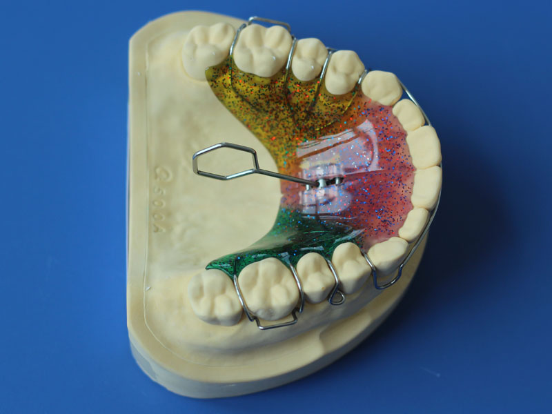 Orthodontic 3