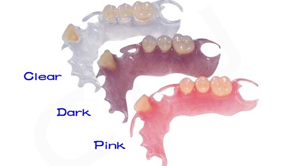 Global Dental Lab:Valplast 2